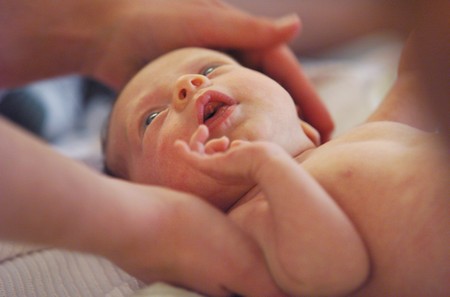 Acne neonatale, un problema che non deve allarmare 