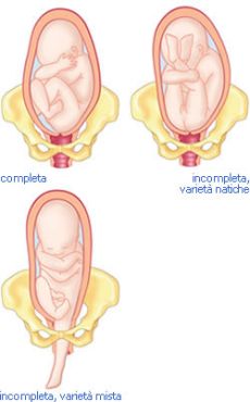 presentazione-fetale