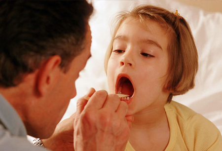 Adenoidi e tonsille: toglierle o lasciarle?
