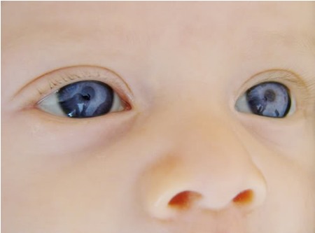 Il colore degli occhi del neonato