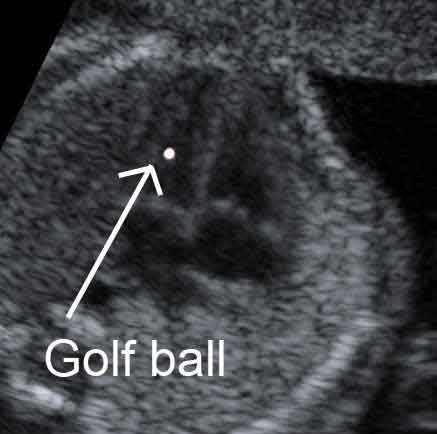 golf-ball