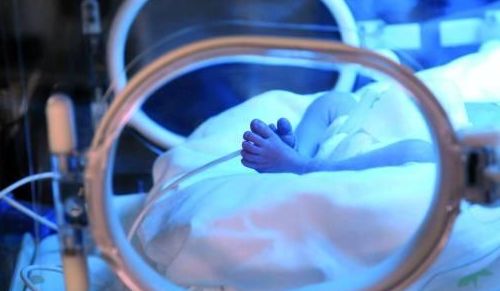 Il primo rene artificiale per neonati, Carpediem