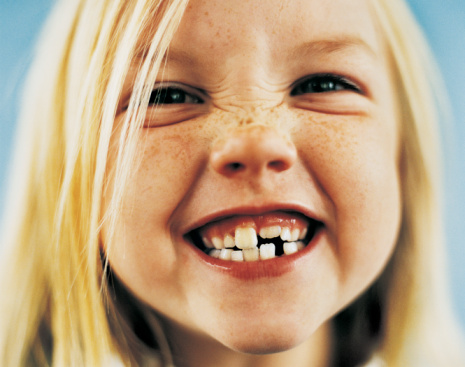 I denti dei bambini a rischio carie già a 4 anni
