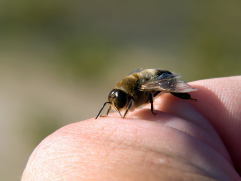 Allergie punture insetti bambini cosa fare