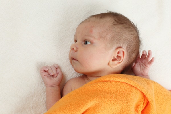 dermatite neonato