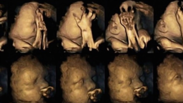 Il fumo in gravidanza fa male: l'ecografia choc che lo dimostra