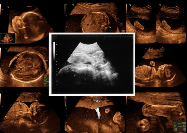Esami in gravidanza, sconsigliate le ecografie prima della 10esima settimana
