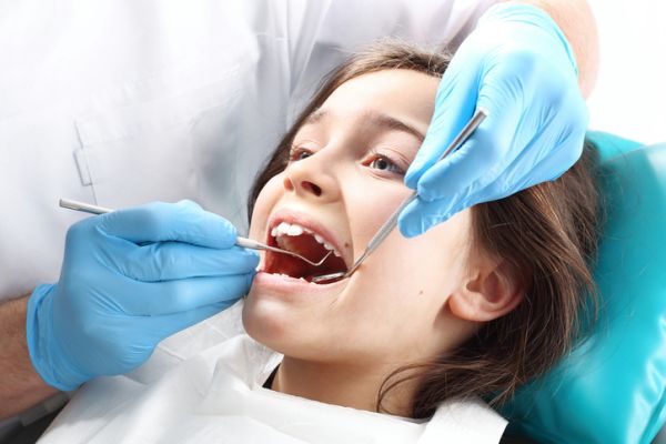 Sigillanti dentali: utili per prevenire le carie nei bambini