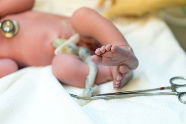 Lotus birth: cos'è, benefici e controindicazioni