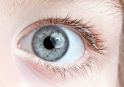Ambliopia (occhio pigro) bambino, sintomi e rimedi