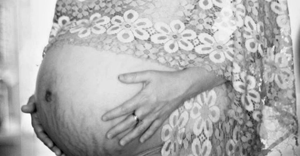 Smagliature post-parto: come eliminarle e tornare in forma!
