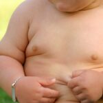 obesità infantile